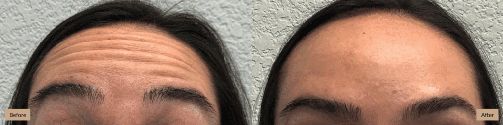 AesthetiCare Medspa, Kansas City MO: Providers & Reviews