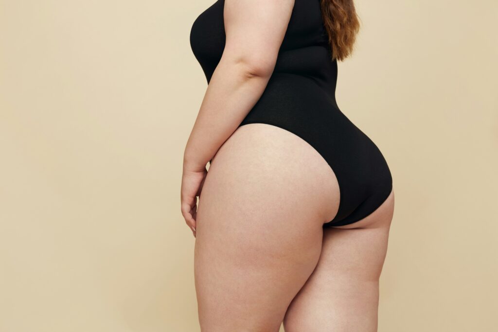 Woman in a black bodysuit showing her side and back profile, representing body transformation after weight-loss surgery.