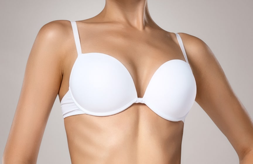 Woman wearing a white bra showing breast shape and contour, commonly used to illustrate breast augmentation or implant related topics